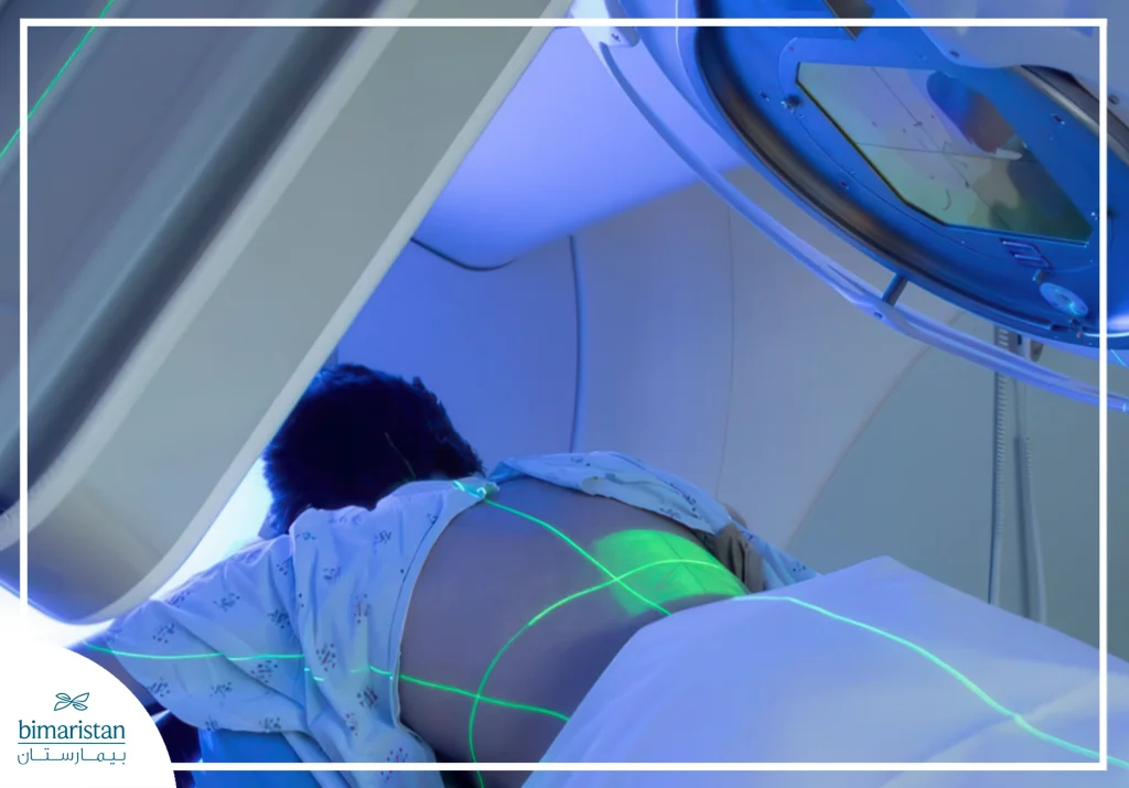 Chest Wall Tumor Treatment: Types, Resection &Amp; Recovery Options 4 Chest Wall Tumor Treatment With Radiation Therapy