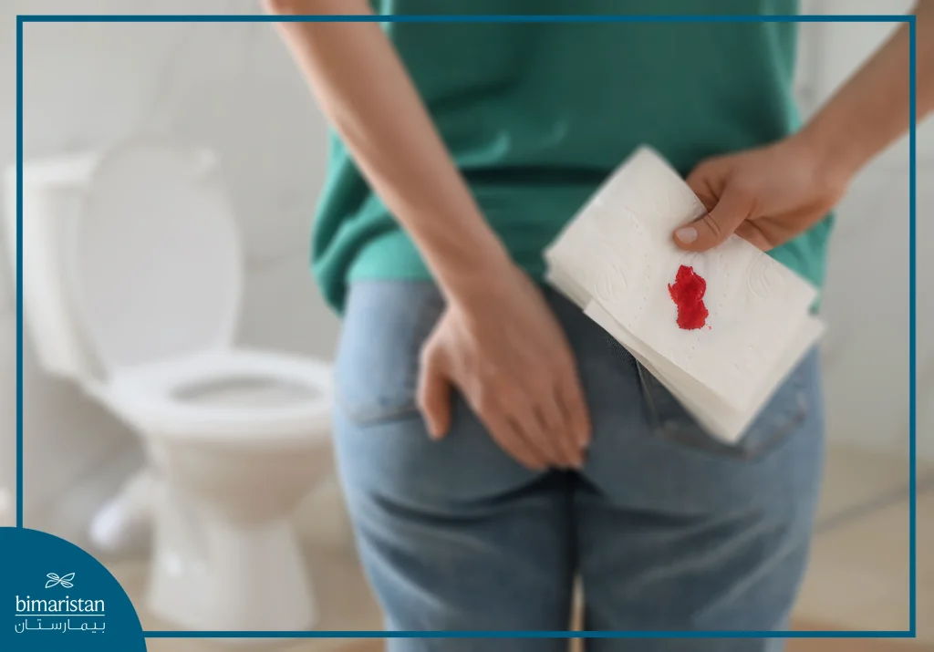 Image Showing Rectal Bleeding After Wiping With A Tissue