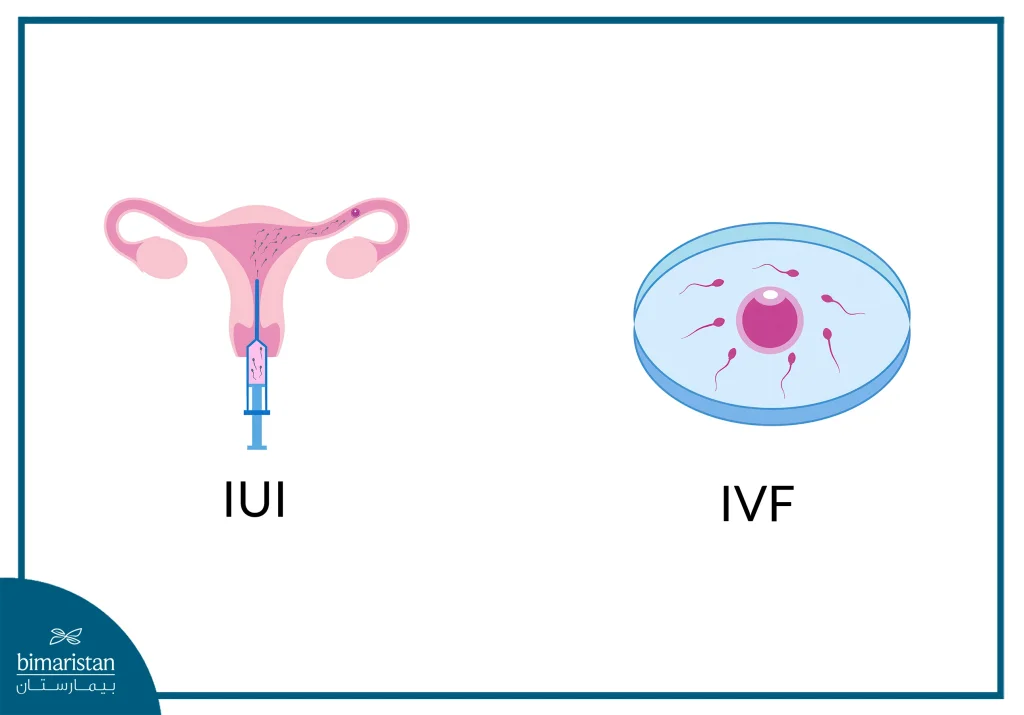 Iui In Turkey: Intrauterine Insemination Procedure &Amp; Success Rates 4 A Simple Comparison Between Intrauterine Injection (Iui) And Ivf In Turkey