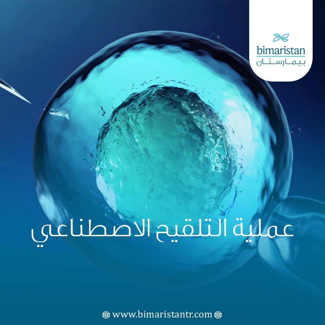 عملية التلقيح الاصطناعي لعلاج العقم في تركيا
