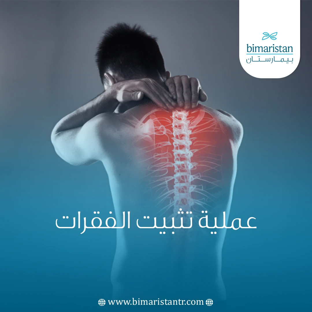عملية تثبيت الفقرات