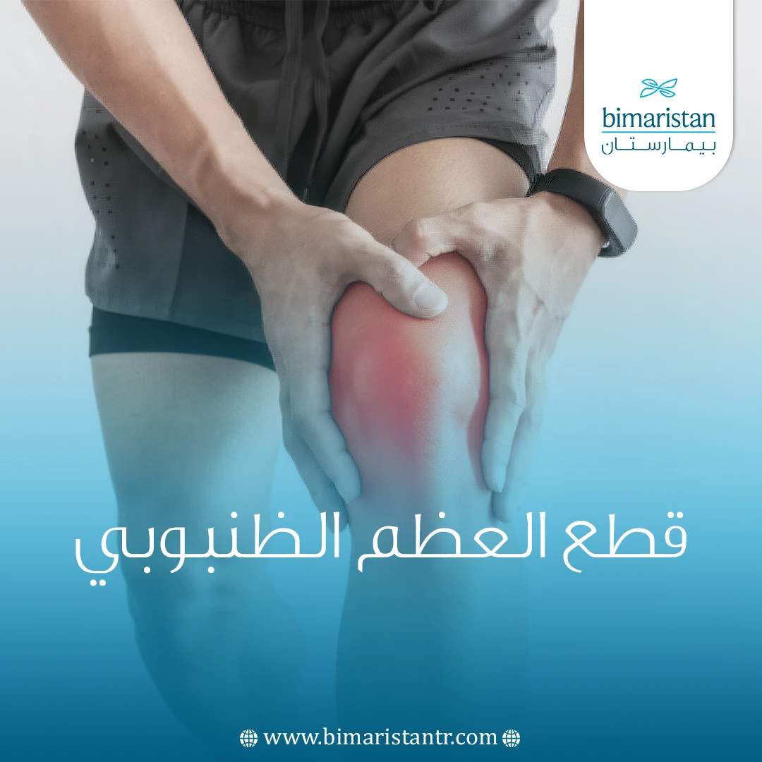قطع العظم الظنبوبي