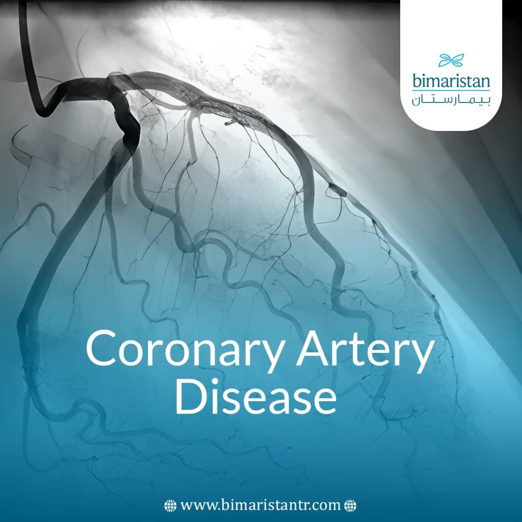 Coronary Artery Disease