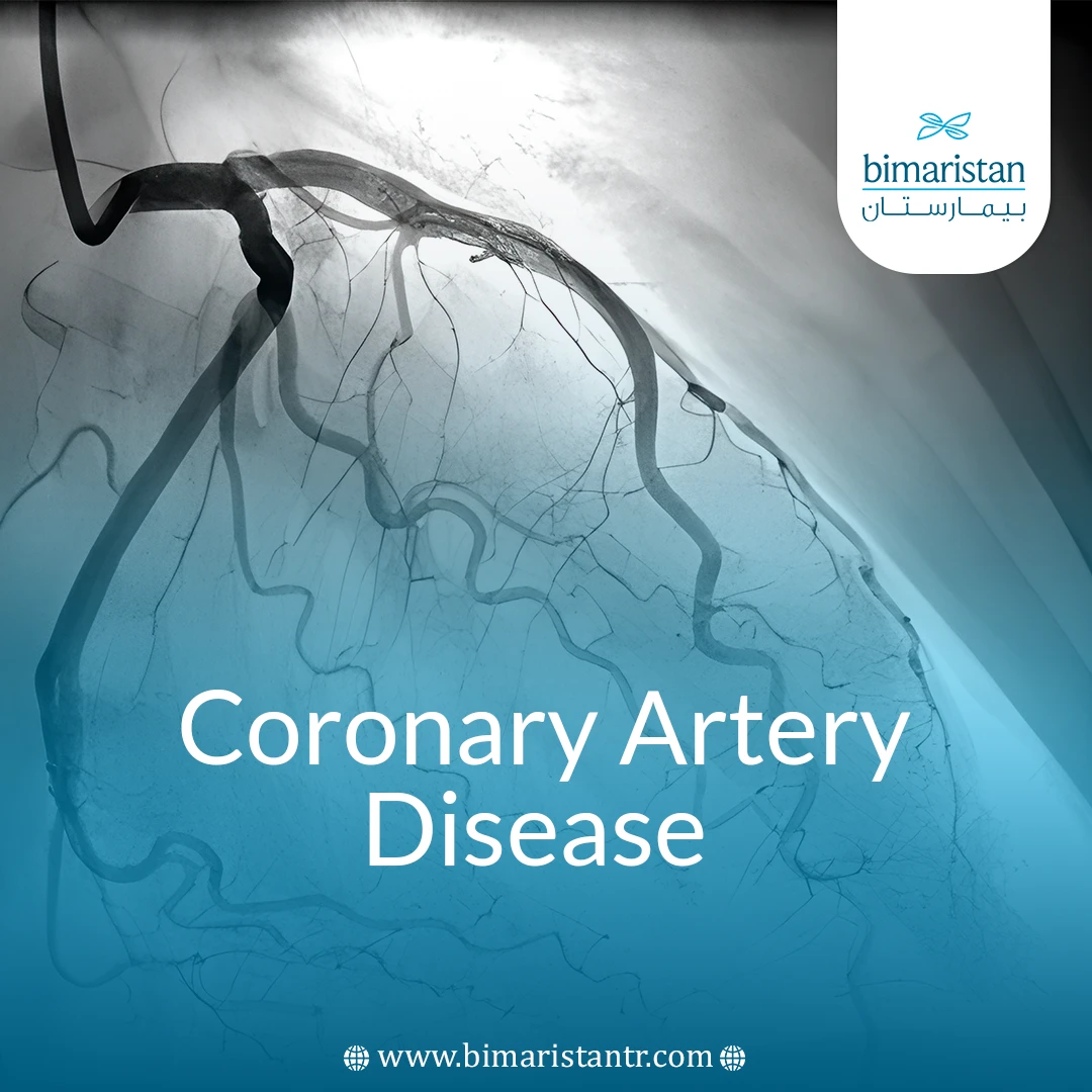 Coronary Artery Disease