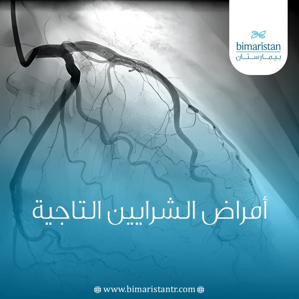 أمراض الشرايين التاجية