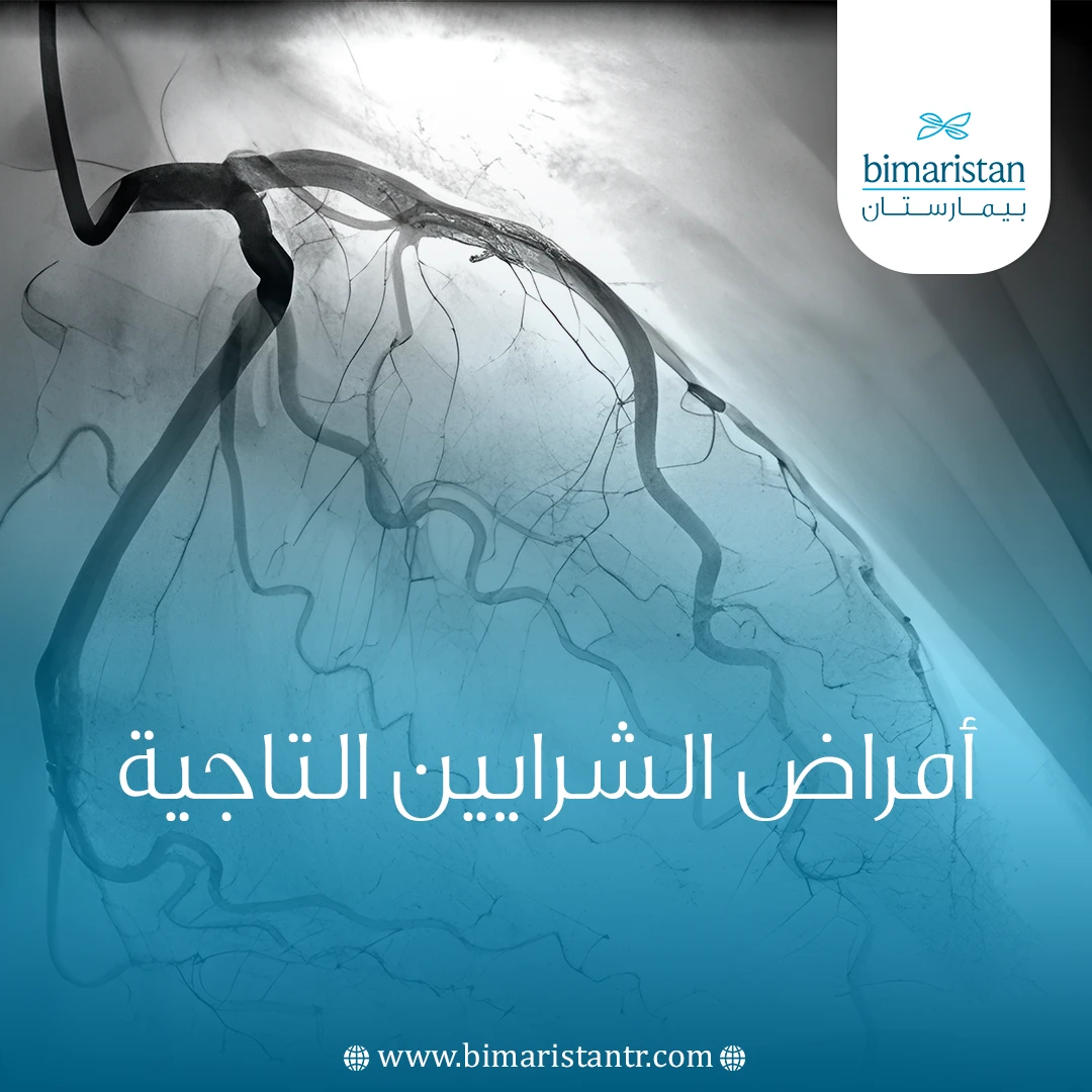 أمراض الشرايين التاجية