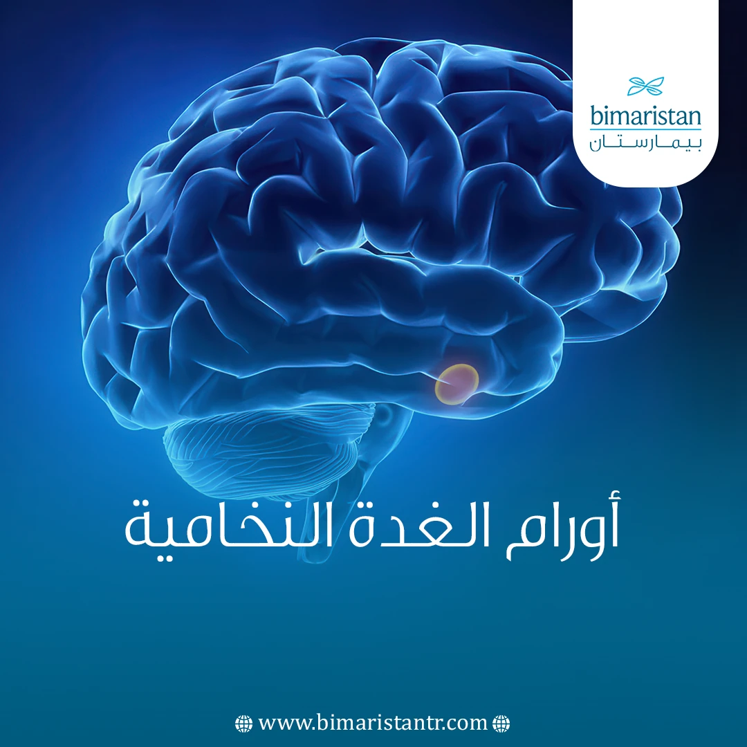 أورام الغدة النخامية أسبابها وأعراضها وعلاجها