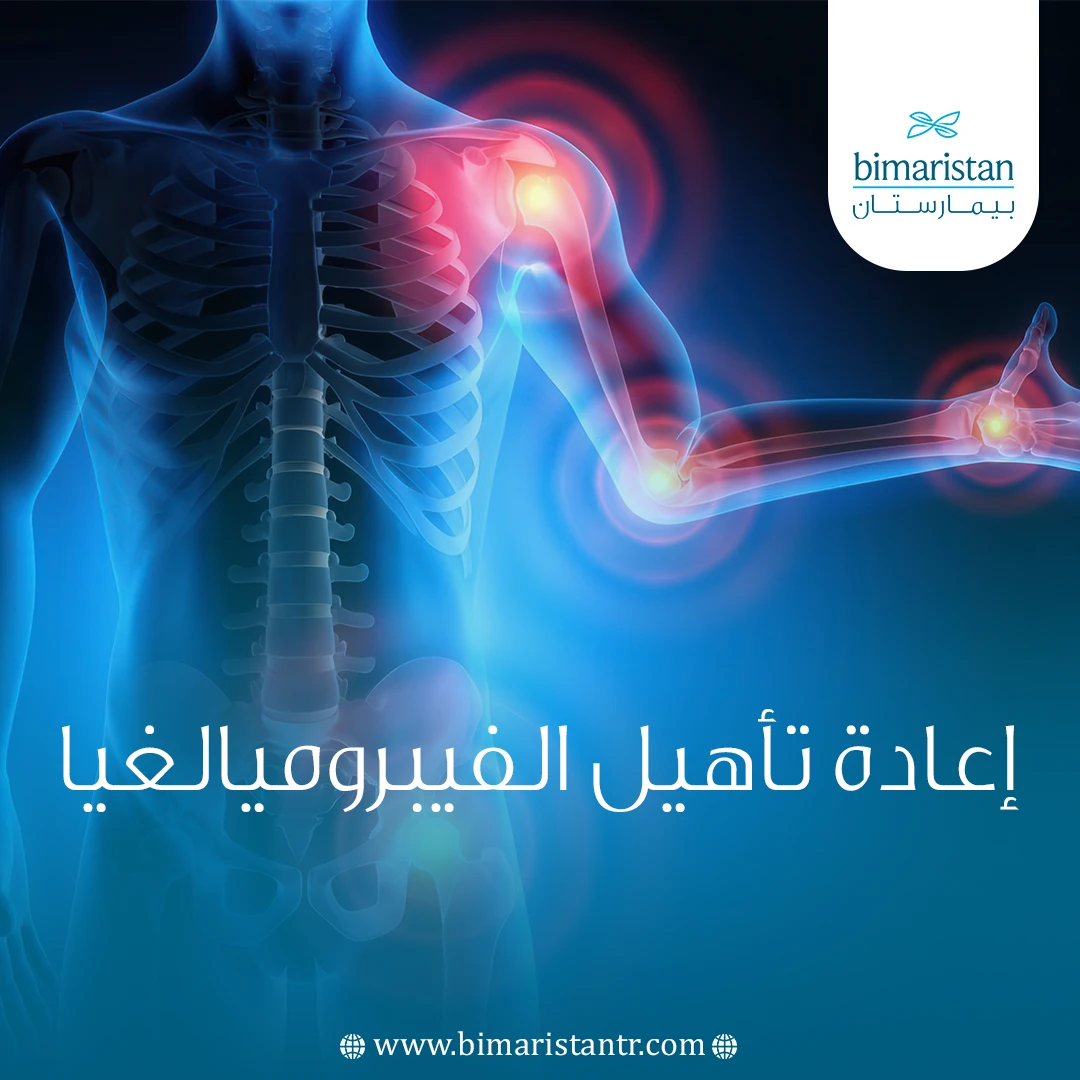 إعادة تأهيل الفيبروميالغيا