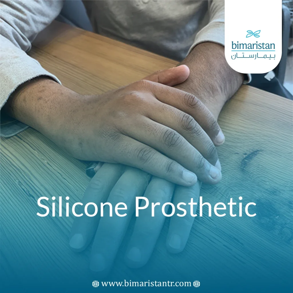 Silicone Prosthetics
