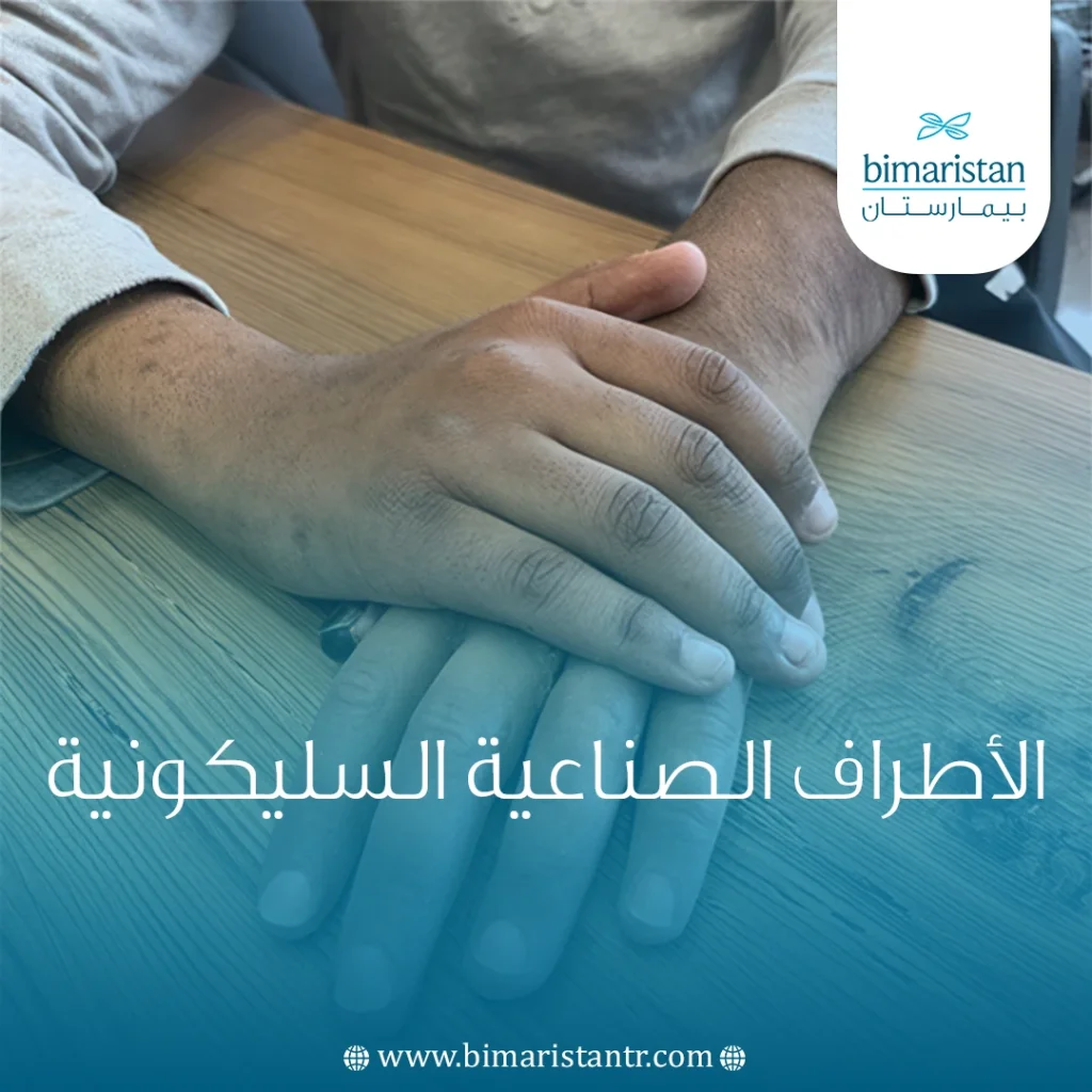 الأطراف الصناعية السيليكونية