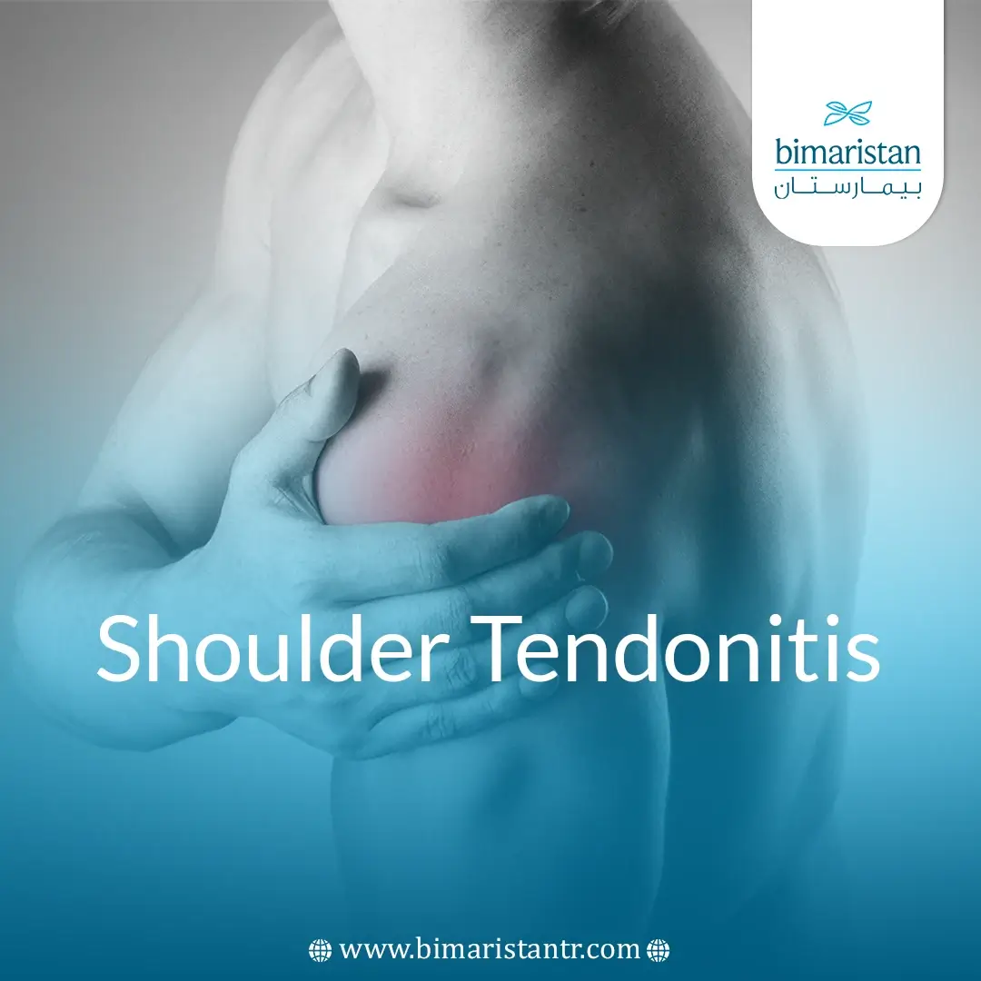 Shoulder Tendonitis
