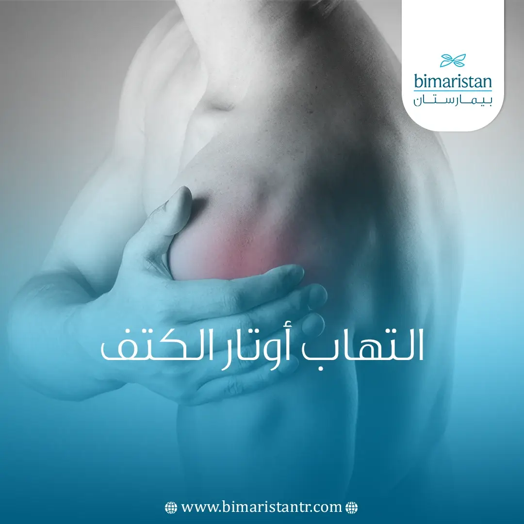 علاج التهاب أوتار الكتف