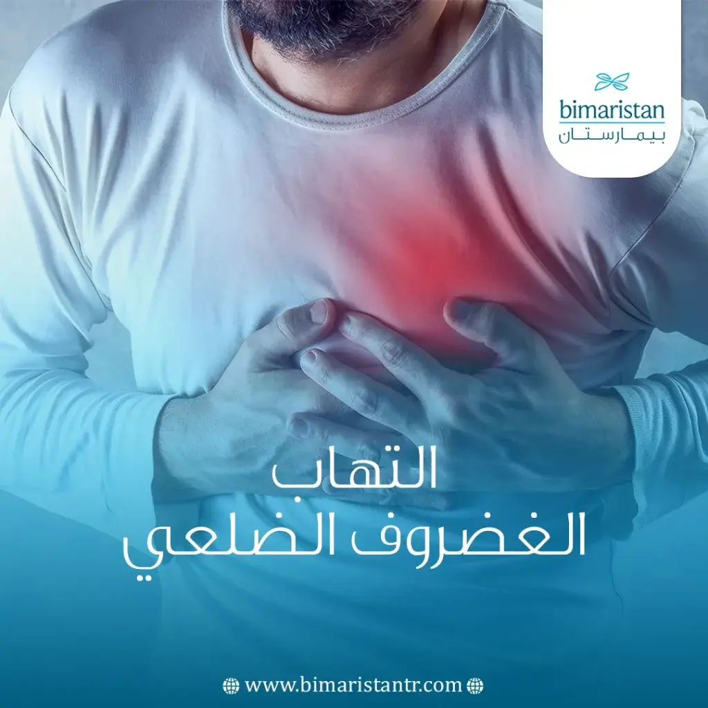 التهاب الغضروف الضلعي
