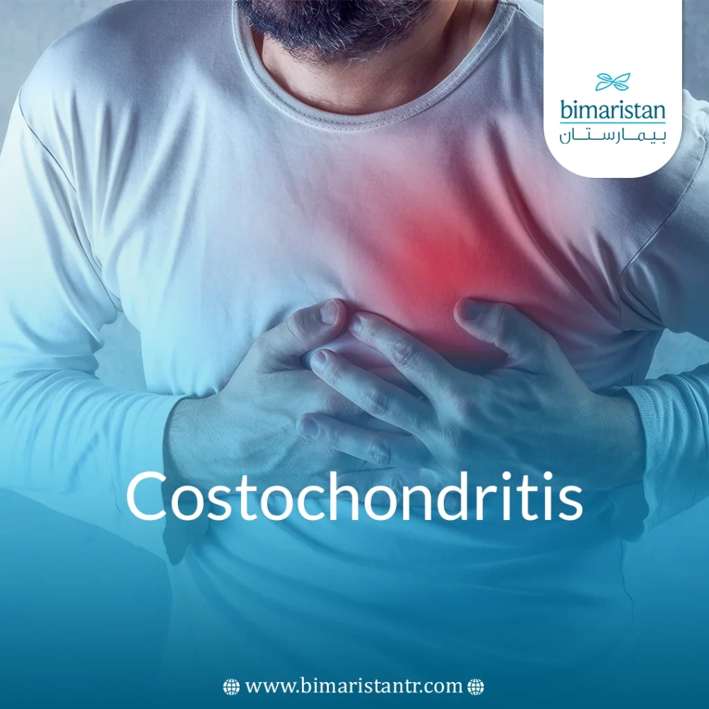 Costochondritis