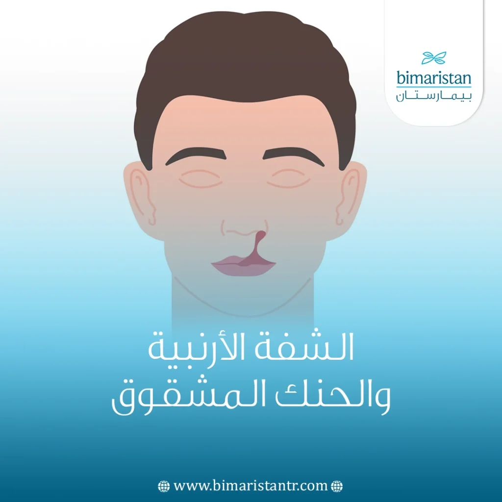 الشفة الأرنبية والحنك المشقوق: الأسباب وسبل العلاج في تركيا