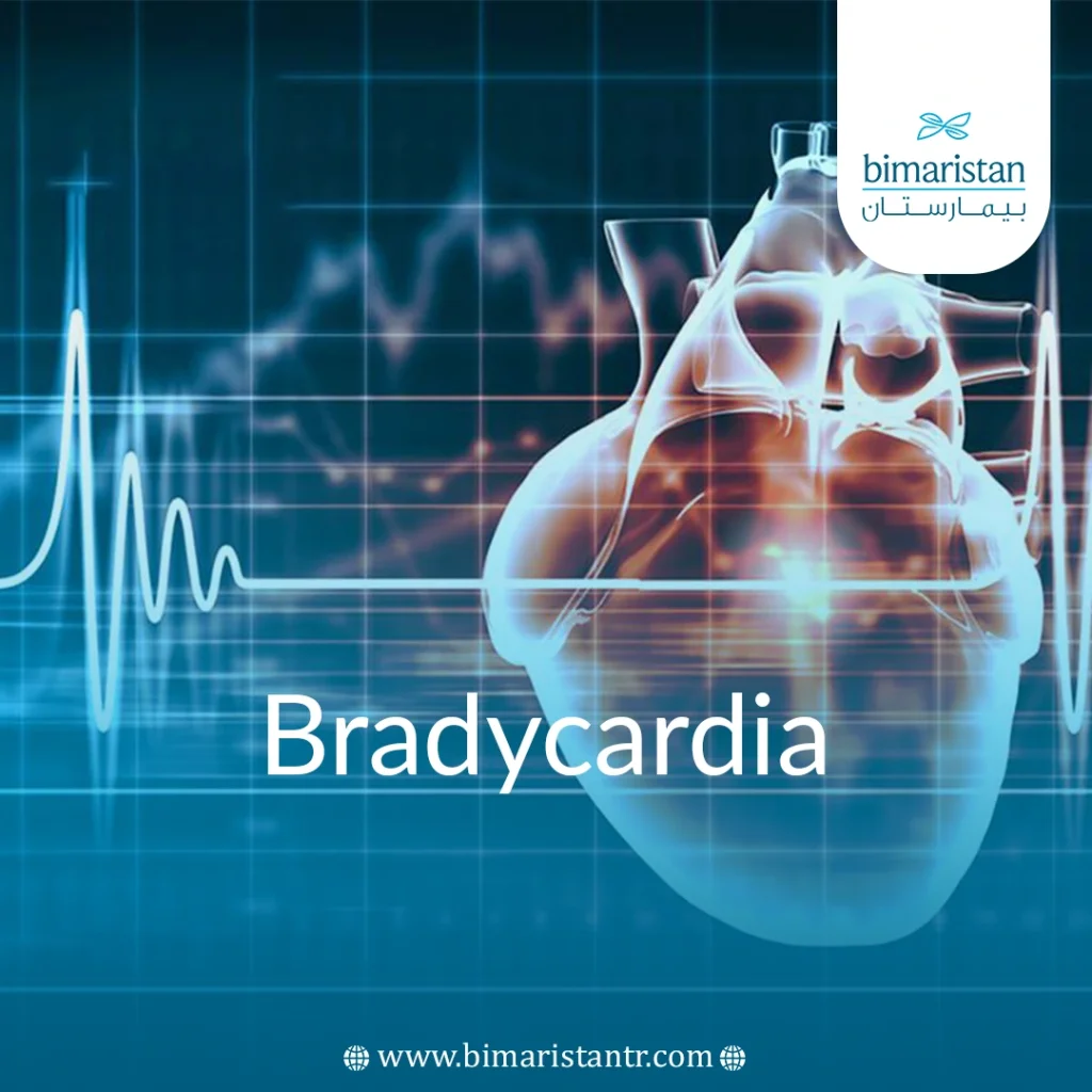 Bradycardia: Symptoms, Causes, And Treatment In Turkey