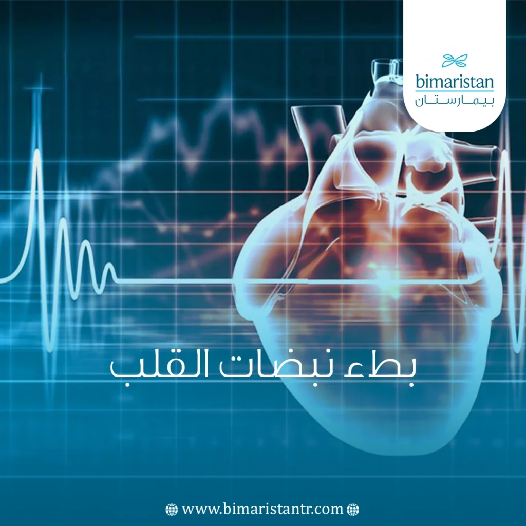 أعراض بطء نبضات القلب وعلاجه بشكل نهائي في تركيا