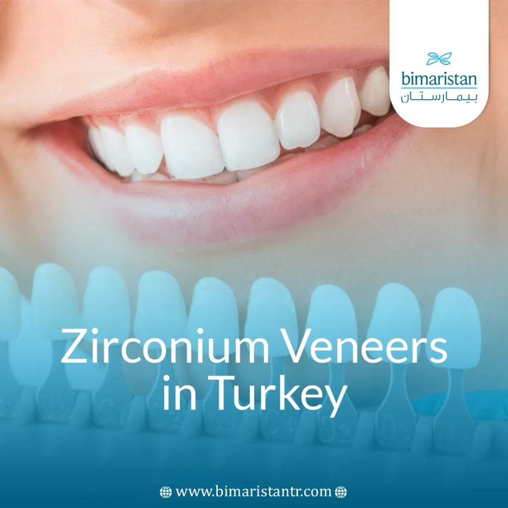 Zirconium Veneers In Turkey: Types, Benefits, And Features