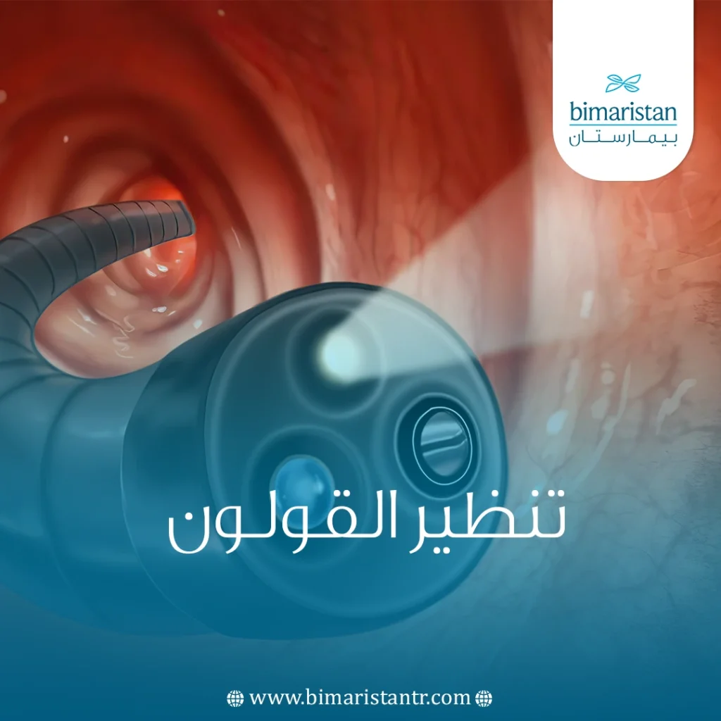عملية تنظير القولون في تركيا