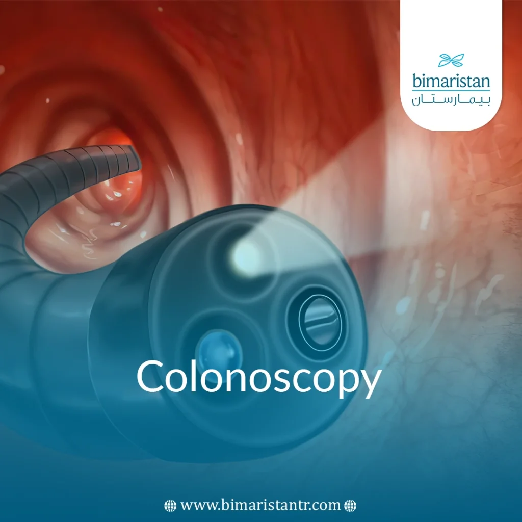 Colonoscopy In Turkey: Benefits &Amp; Prep Guide For Procedure