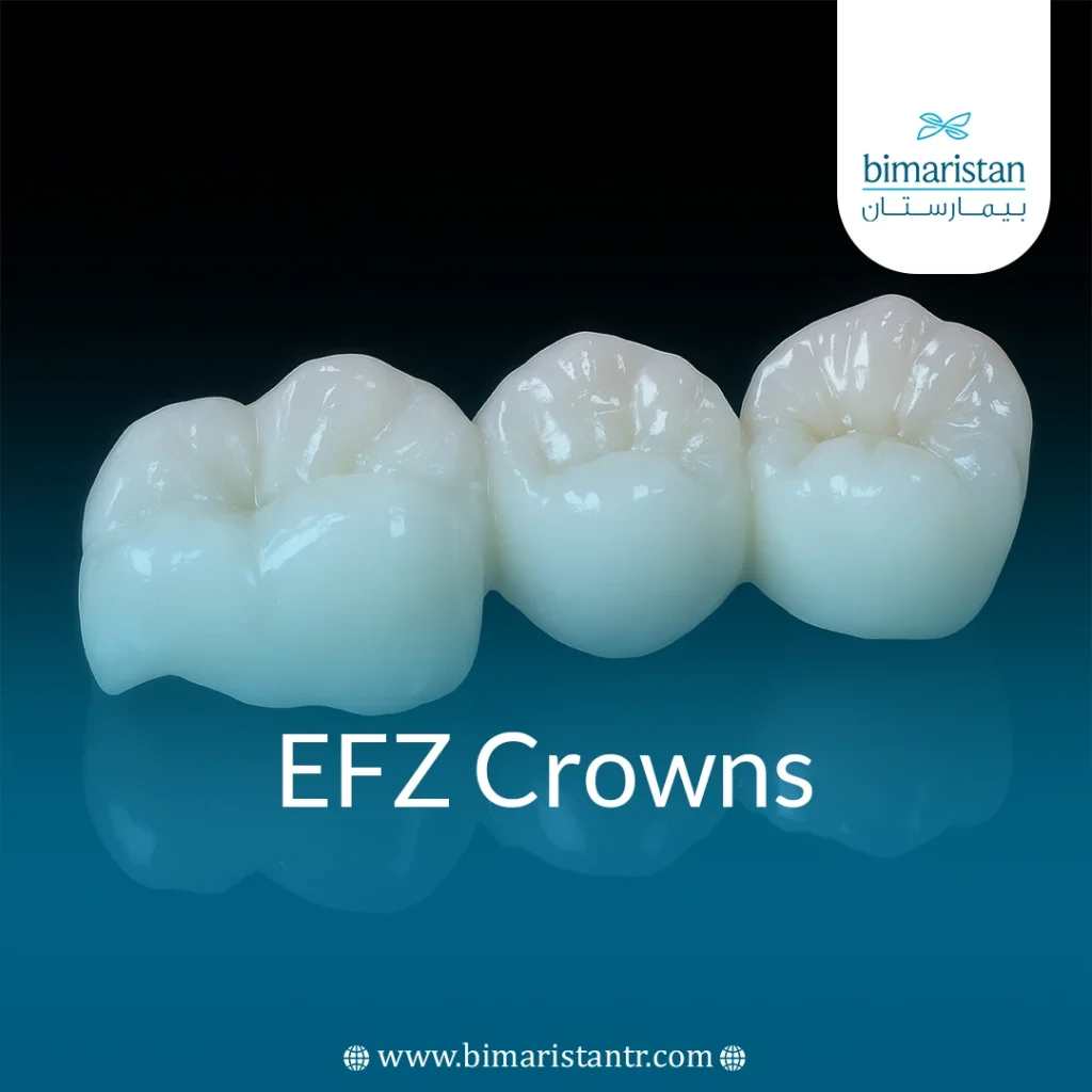 Efz Crowns: Zirconium Strength &Amp; Emax Aesthetics Combined