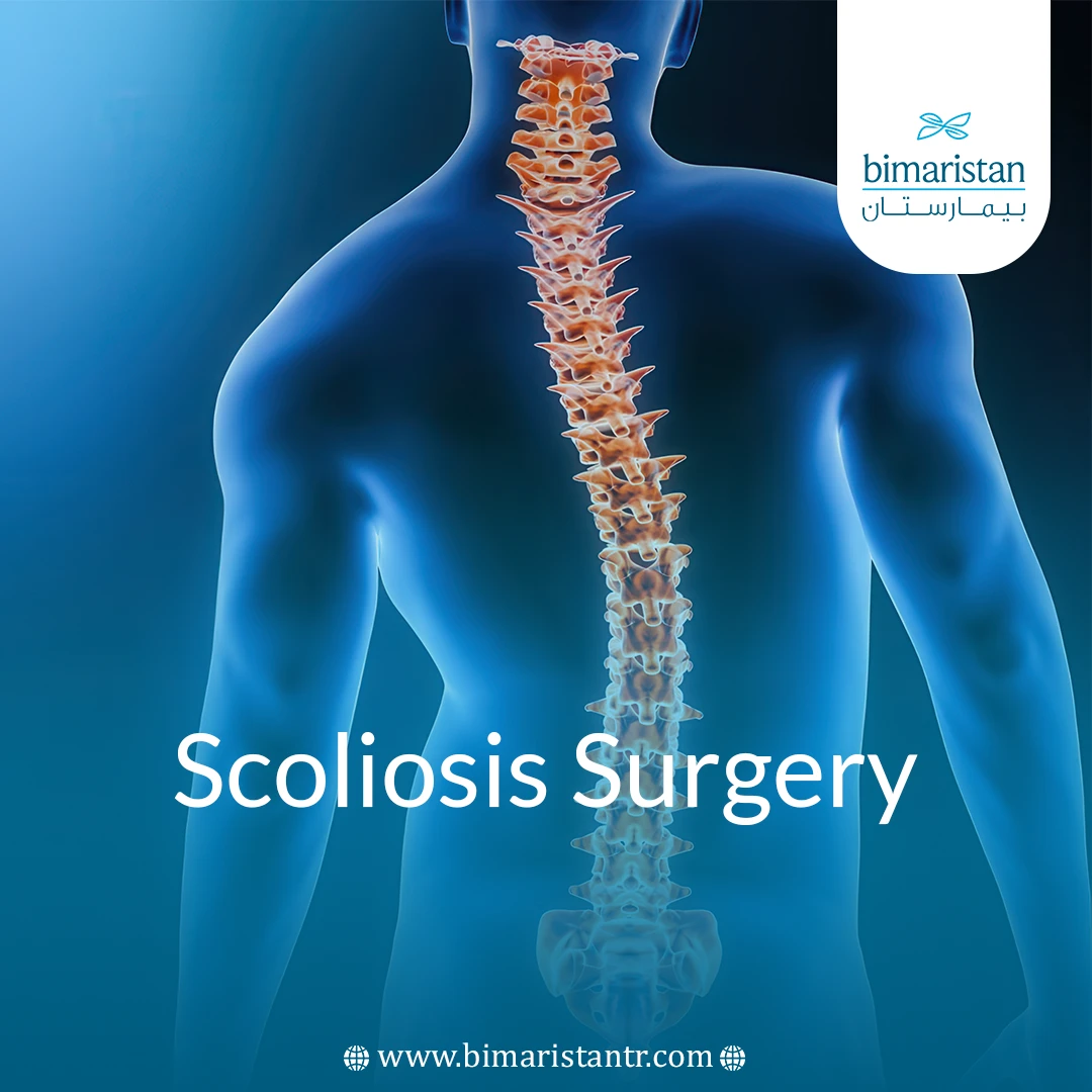 Scoliosis Surgery