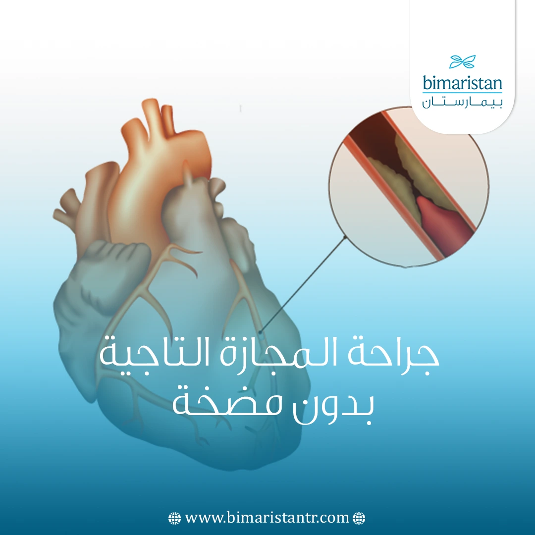 جراحة المجازة التاجية بدون مضخة في تركيا