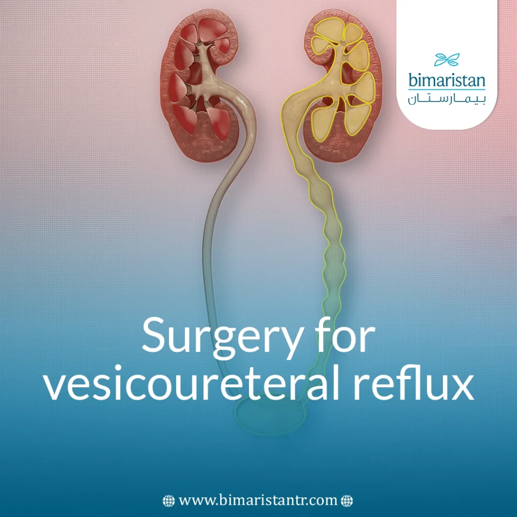 Surgery For Vesicoureteral Reflux