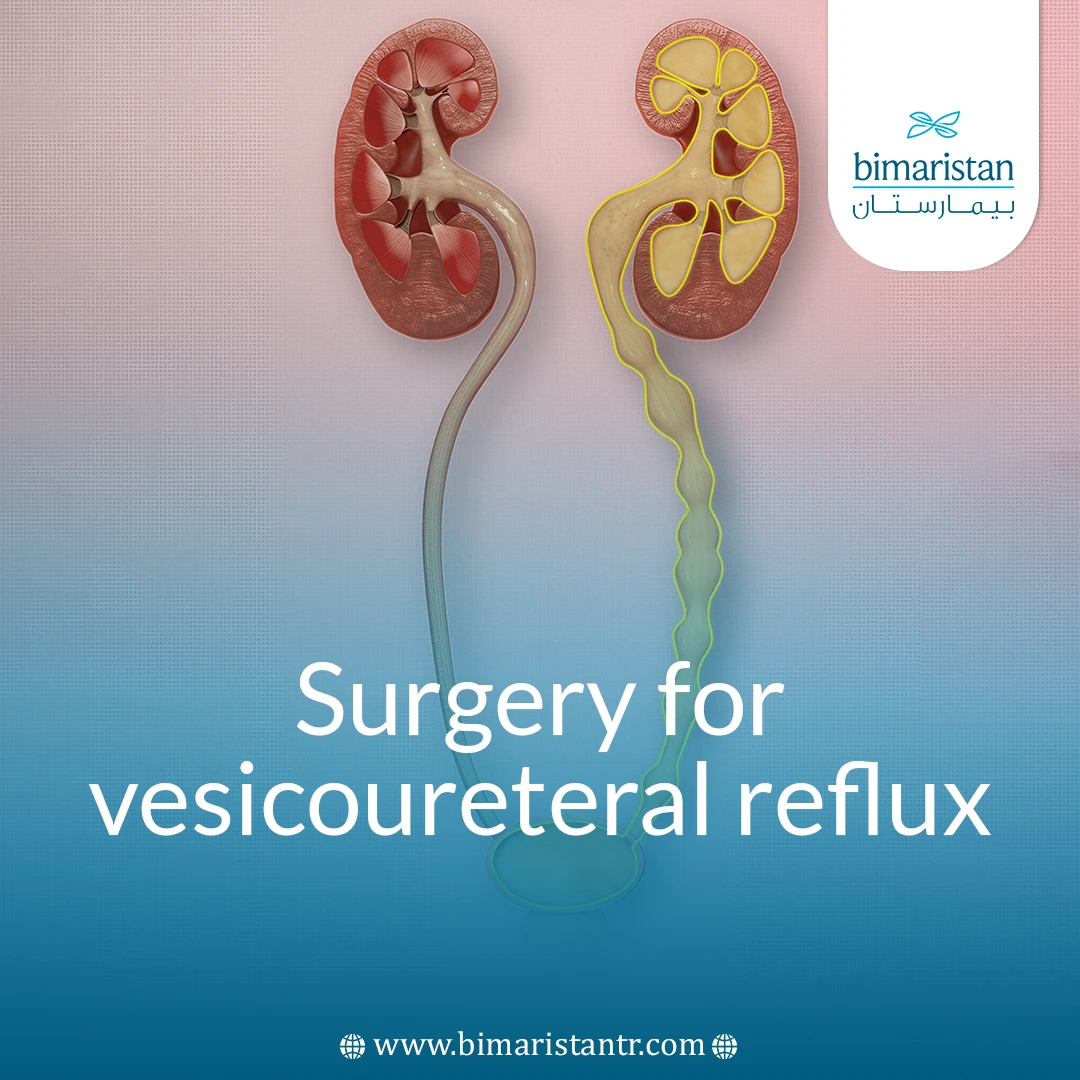 Surgery For Vesicoureteral Reflux