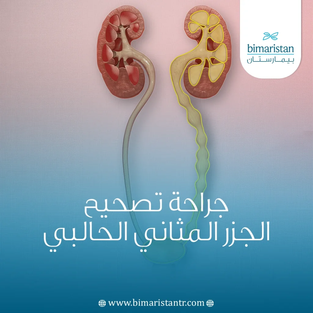 جراحة تصحيح الجزر المثاني الحالبي: الحل الفعال لمشكلة الجزر المثاني