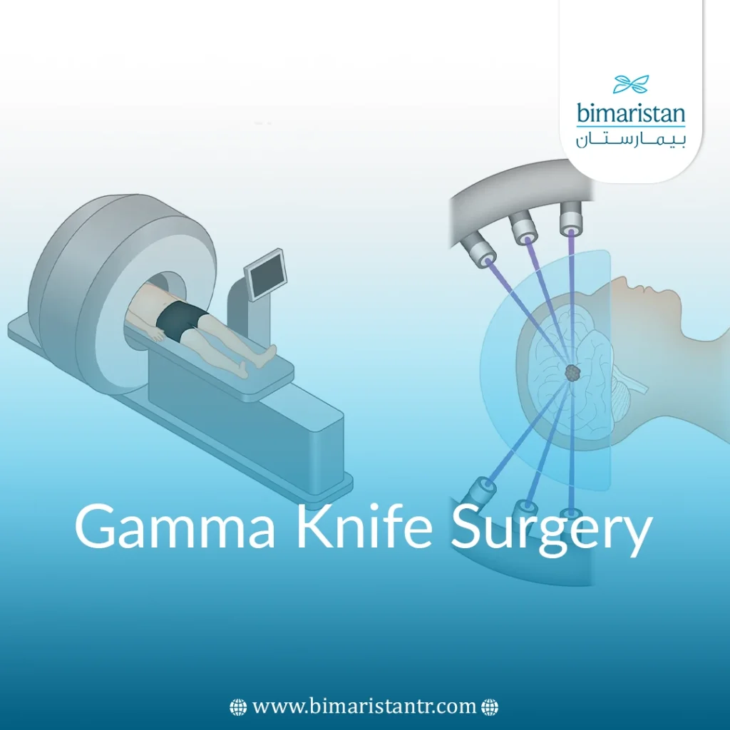 Gamma Knife Surgery