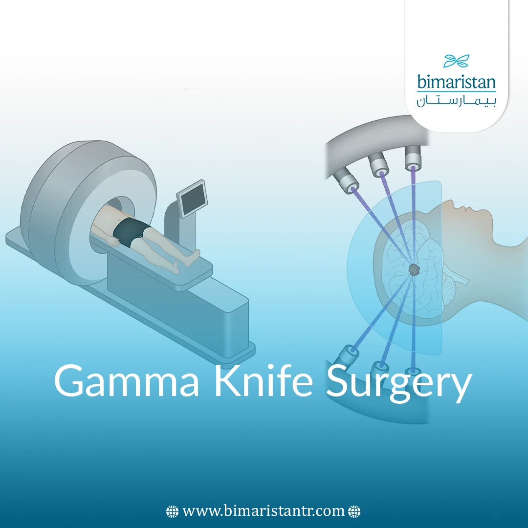 Gamma Knife Surgery