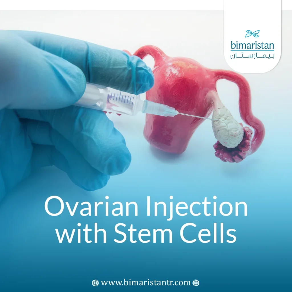 Ovarian Injection With Stem Cells: The Latest Infertility Treatment In Turkey 2025