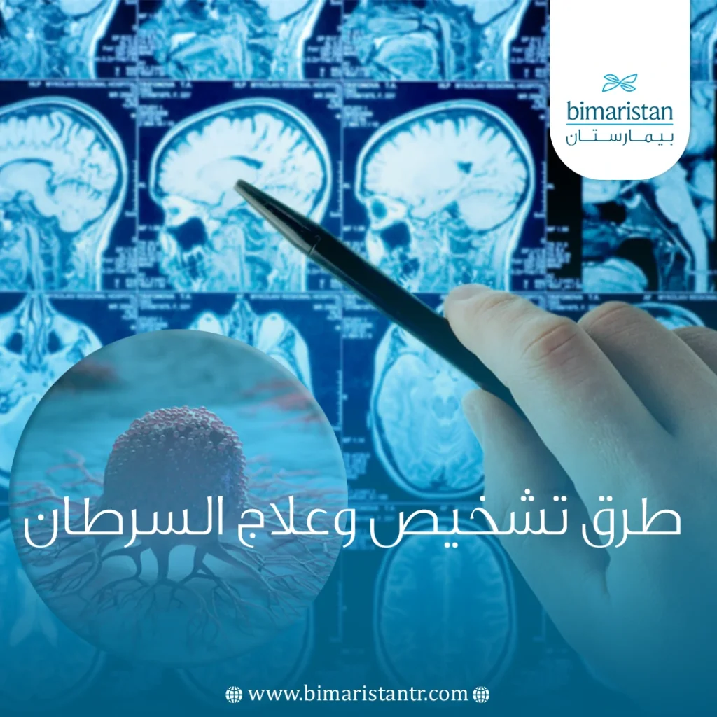 طرق تشخيص وعلاج السرطان في تركيا