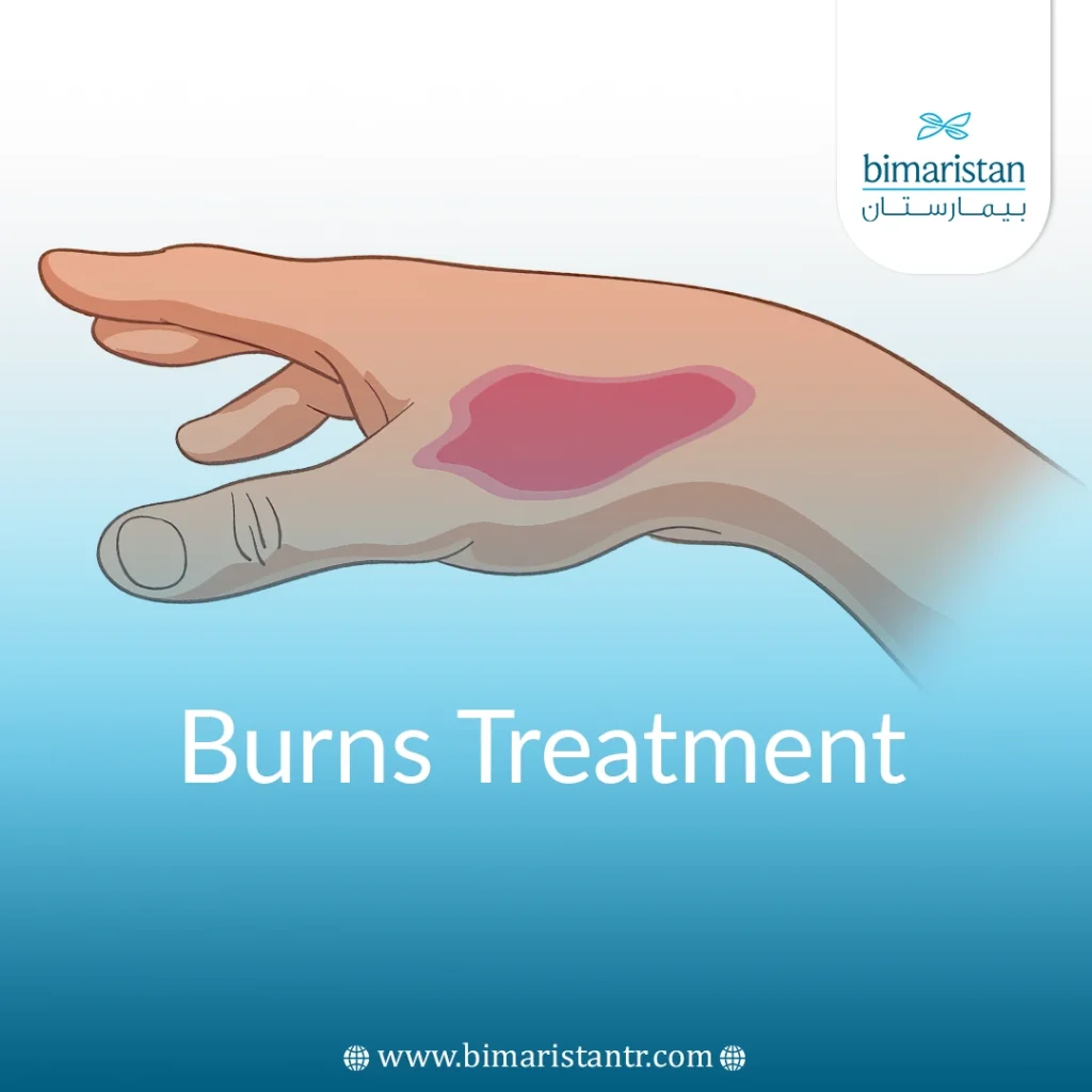 Burns Treatment In Turkey