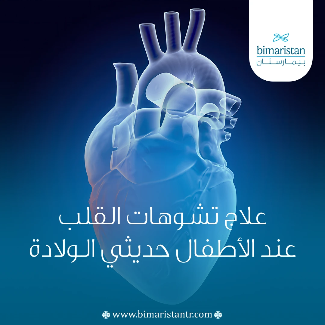 علاج تشوهات القلب عند الأطفال حديثي الولادة