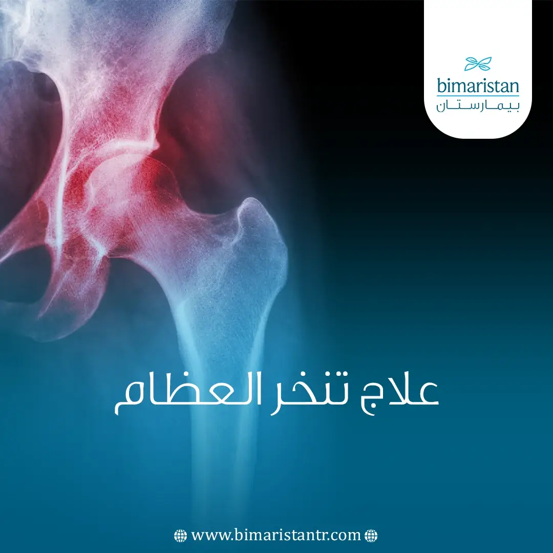 علاج تنخر العظام