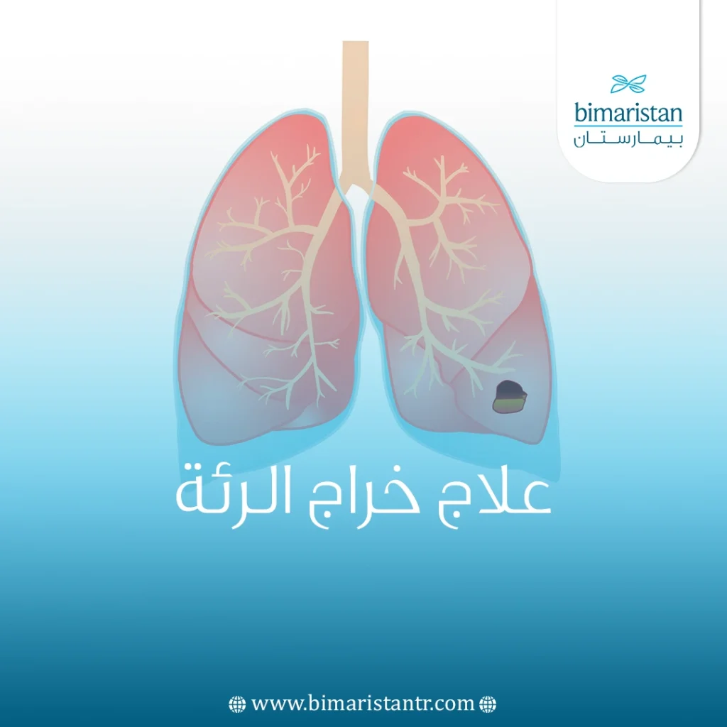 صورة غلاف لمقالة علاج خراج الرئة