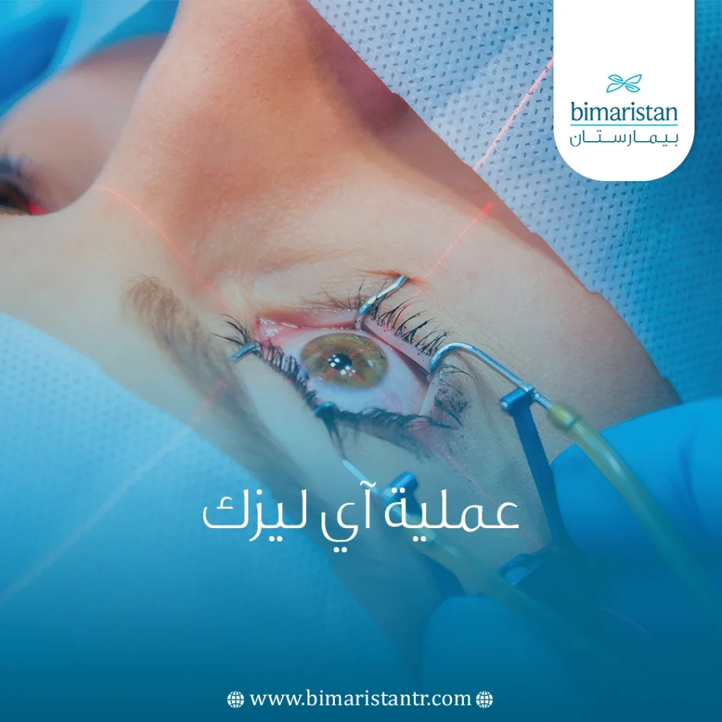 عملية آي ليزك