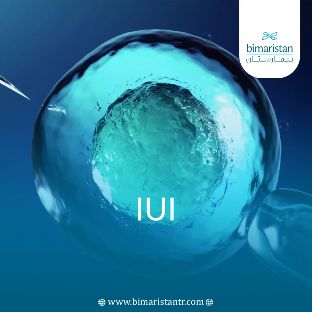 The Image Shows The Injection Of A Man’s Sperm Into The Uterus Using A Special Needle. These Methods Are Considered Iui Methods, As The Iui Process Is Used To Treat Infertility In Couples.