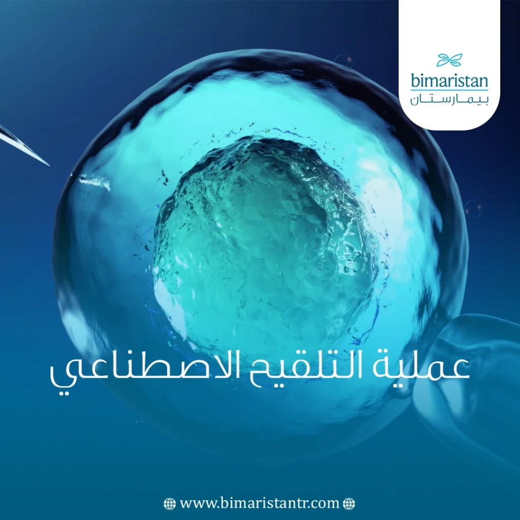 عملية التلقيح الاصطناعي لعلاج العقم في تركيا