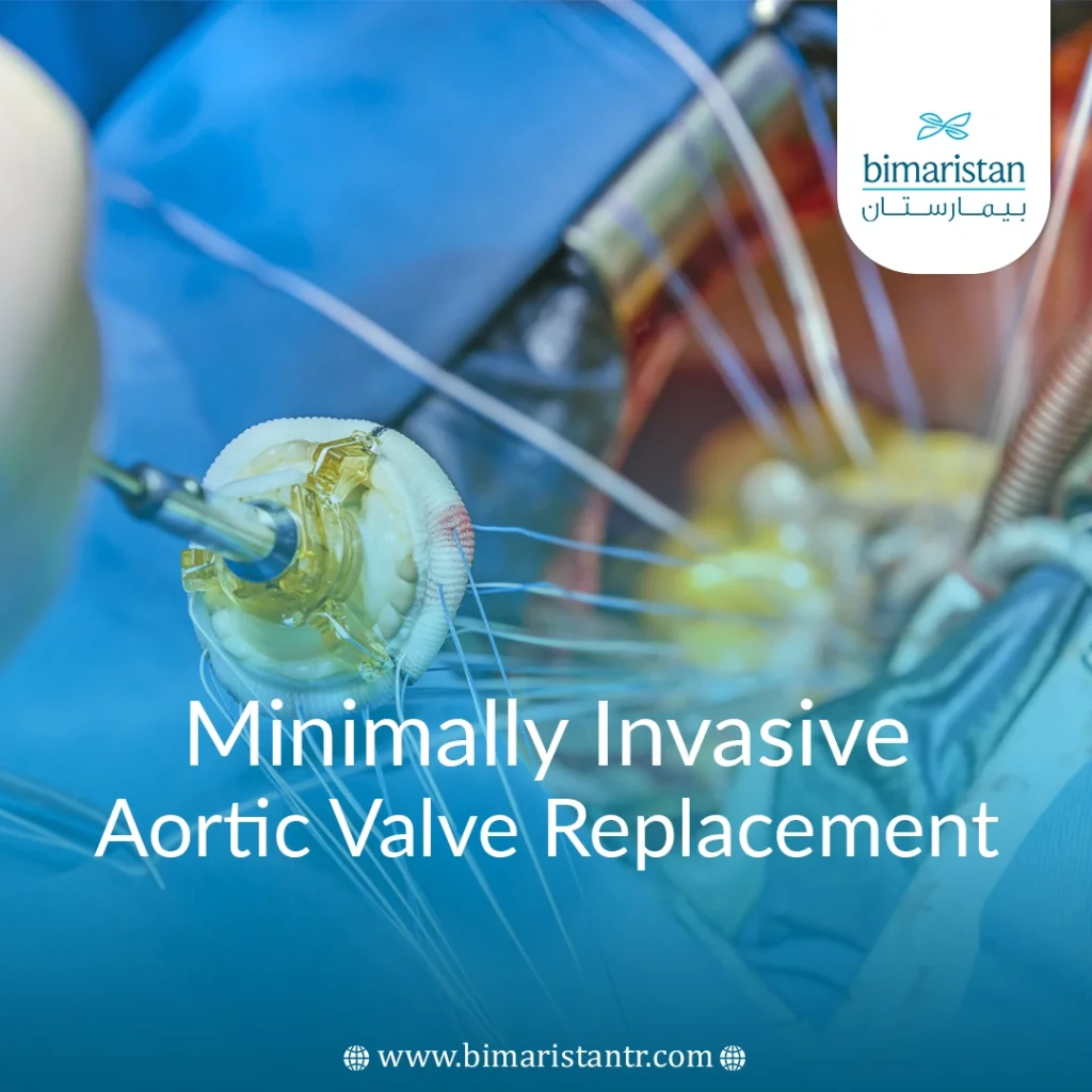 Minimally Invasive Aortic Valve Replacement In Turkey
