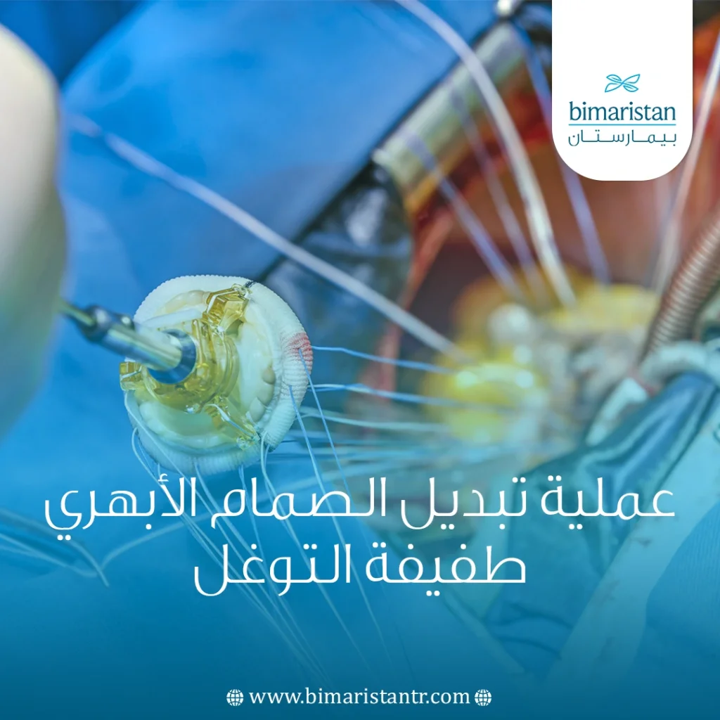 عملية تبديل الصمام الأبهري طفيفة التوغل في تركيا