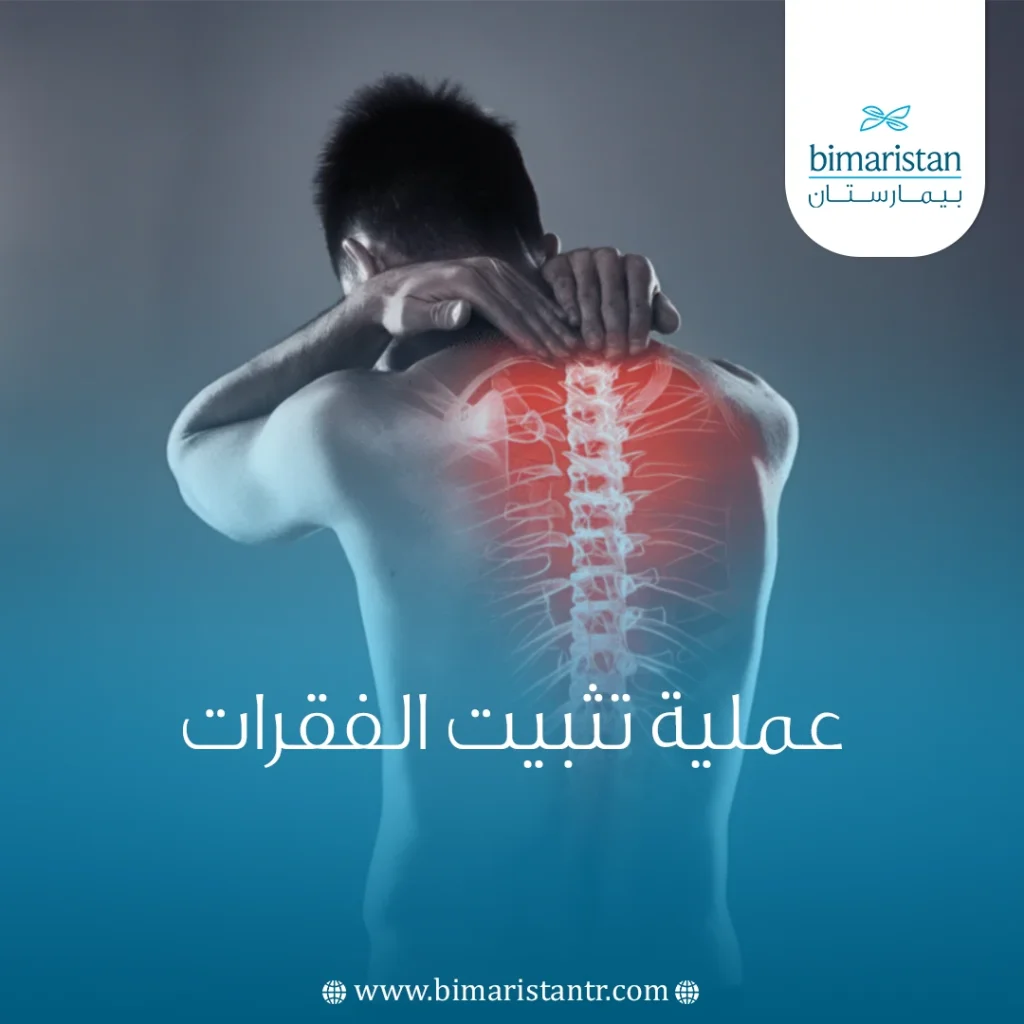 عملية تثبيت الفقرات