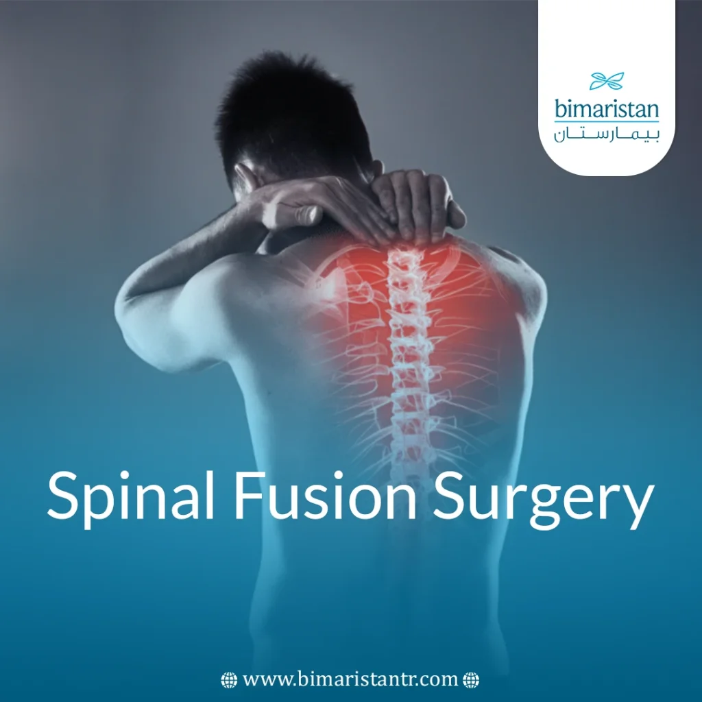 Spinal Fusion Surgery