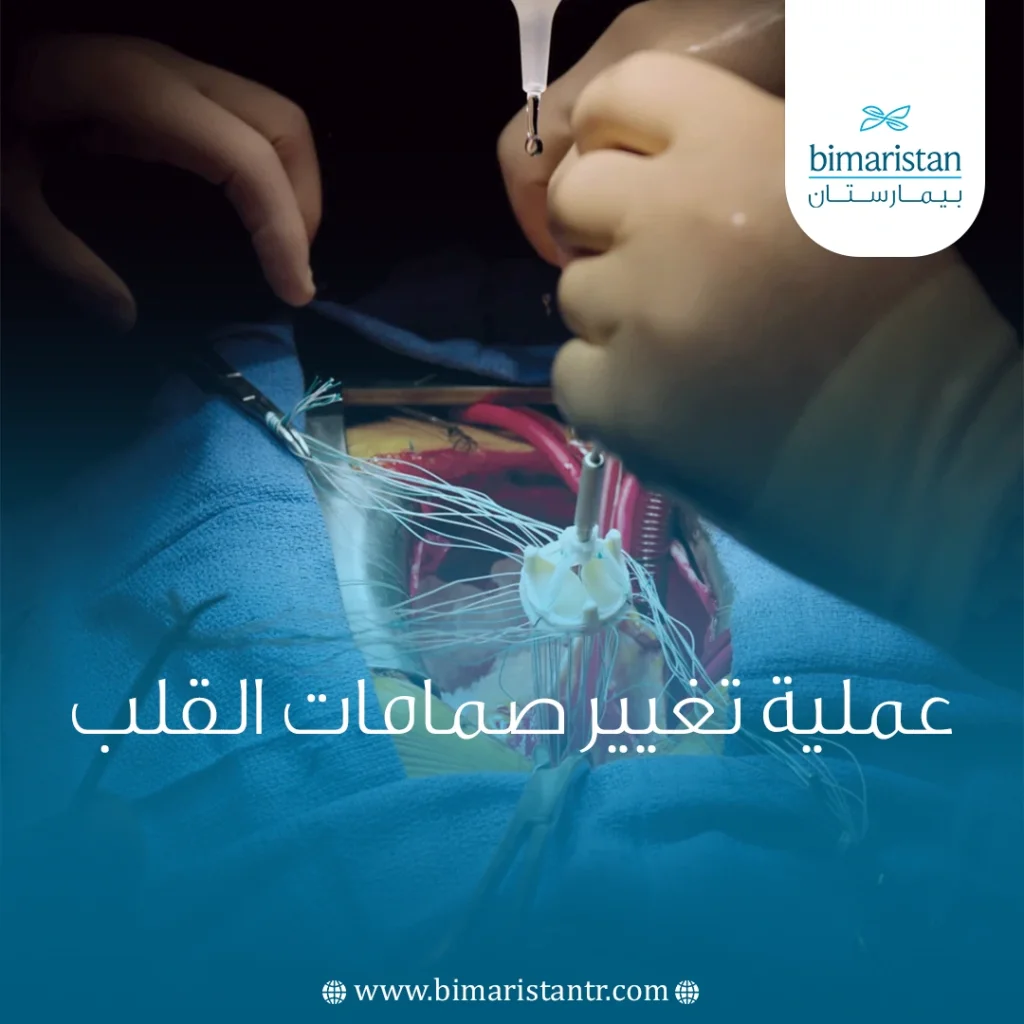 عملية تغيير صمامات القلب في تركيا