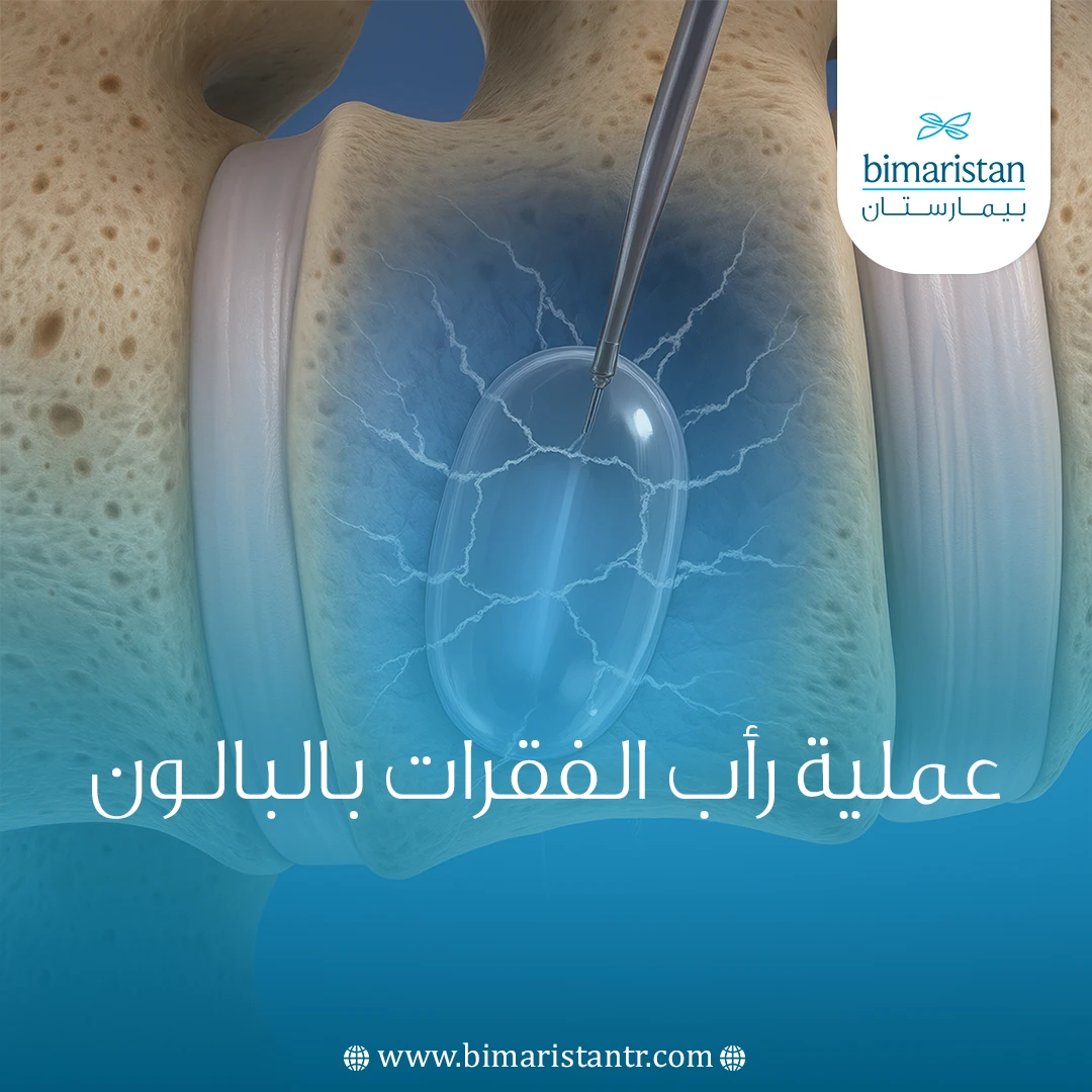 عملية رأب الفقرات بالبالون