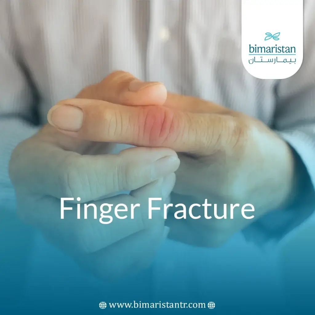 Finger Fractures: Clinical Assessment And Treatment Options 8 Finger Fracture