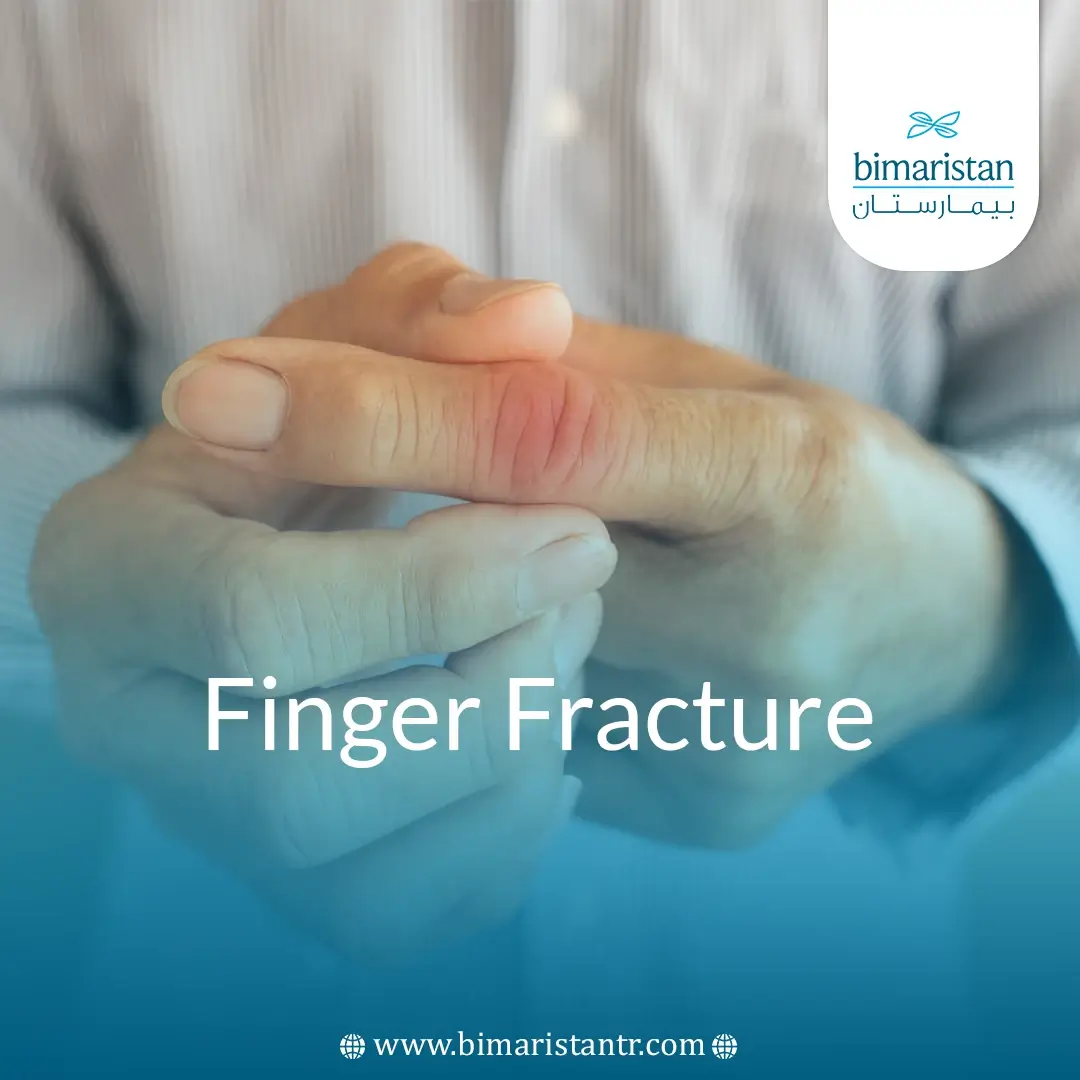 Finger Fracture