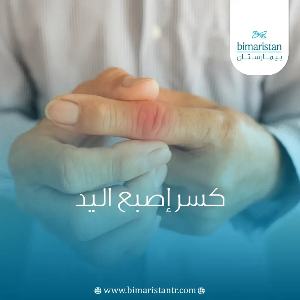كسر إصبع اليد